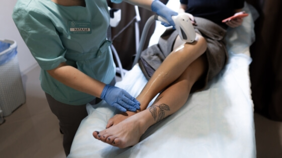 эпиляция лазерная ног полностью