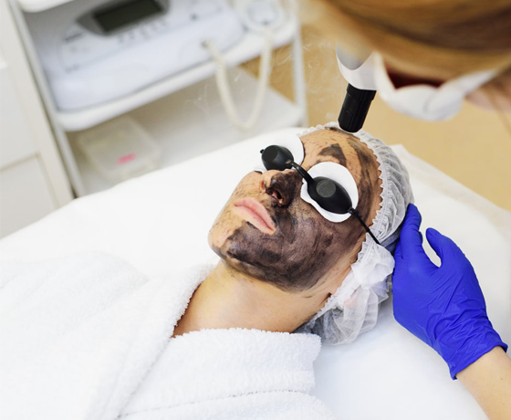 карбоновый пиллинг лица