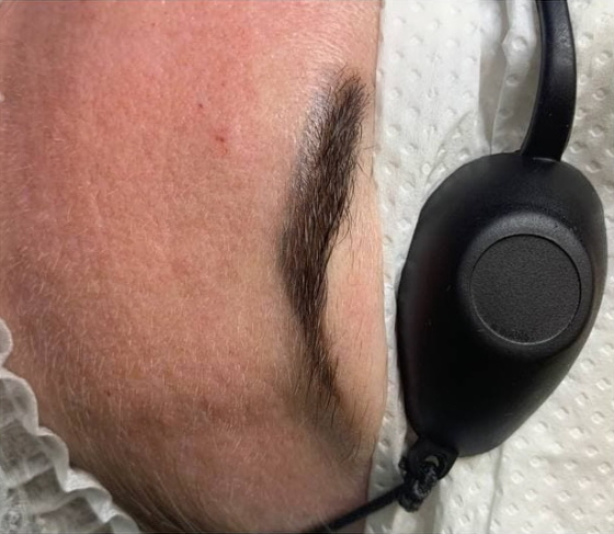 до удаления перманентного макияжа